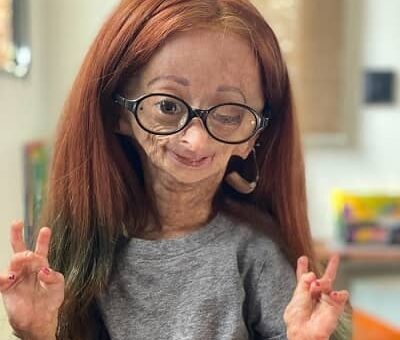 Adalia Rose